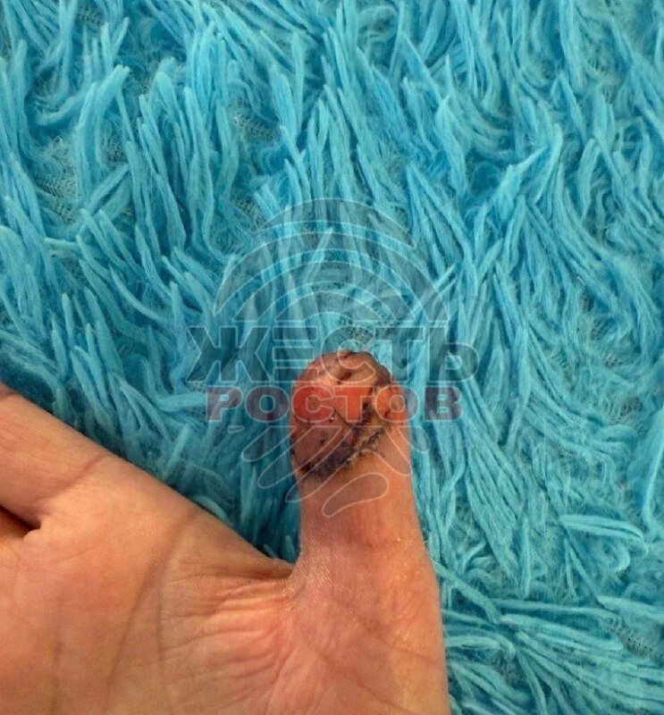    Фото: ТГ канала «Жесть Ростов»