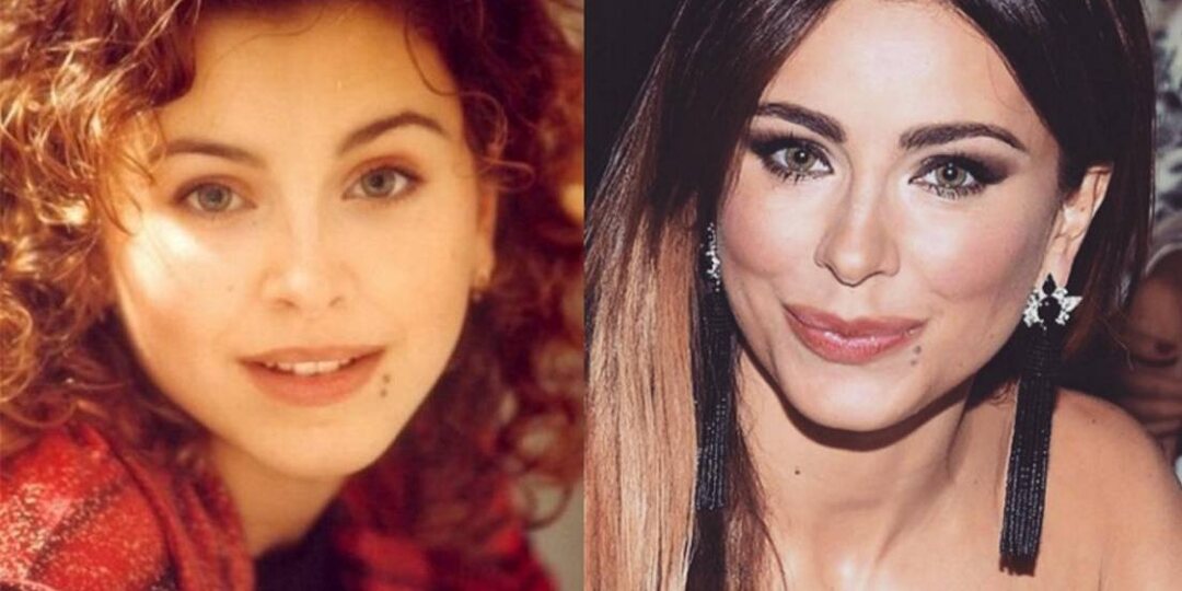 Ани Лорак: натуральность или операции — что выбирает звезда для поддержания молодости?