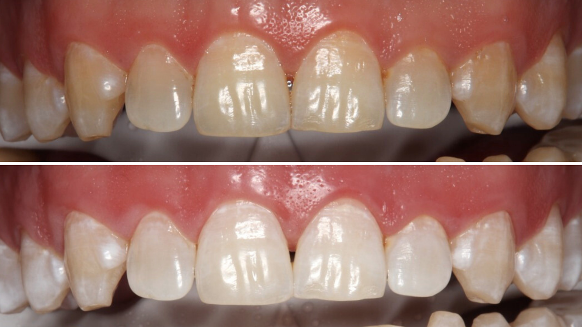 Сравниваем до и после. 