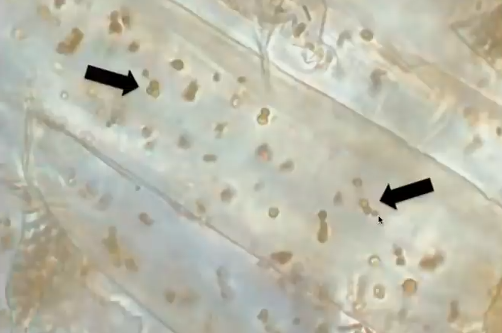 Микроорганизмы в клетках корня при цикле ризофагии.