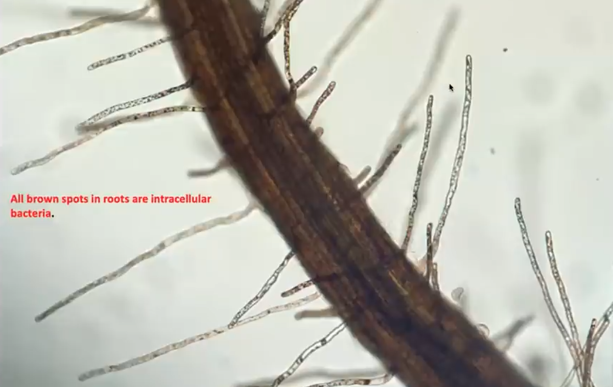 Корневые волоски под микроскопом при ризофагии