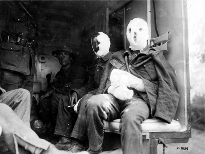 Солдаты, получившие увечия во время газовой атаки.