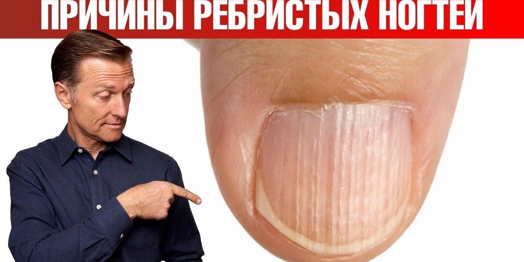 Ребристые ногти: о каких проблемах в организме они предупреждают