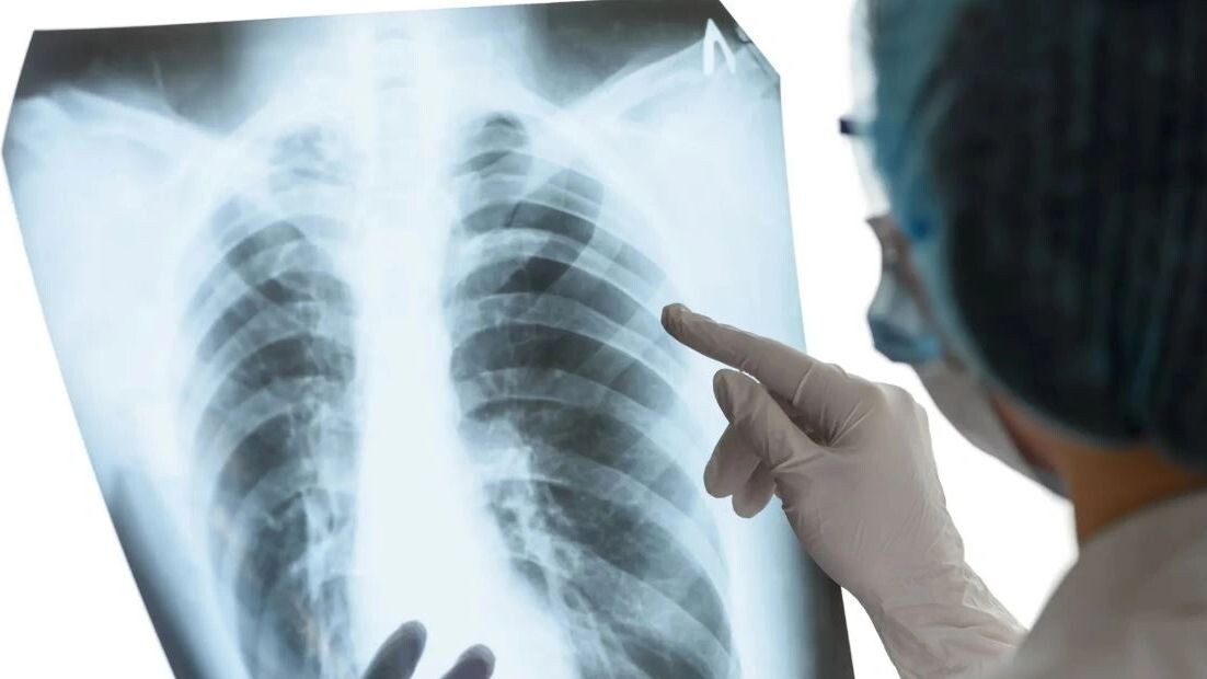    Фото: Andrey Zhernovoy/Shutterstock/Fotodom