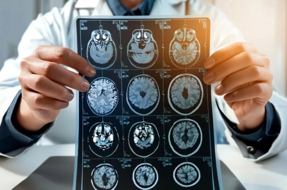    Особый тау-белок, типичный для болезни Альцгеймера, образуется в процессе борьбы нашей собственной иммунной системы с вирусами герпеса.