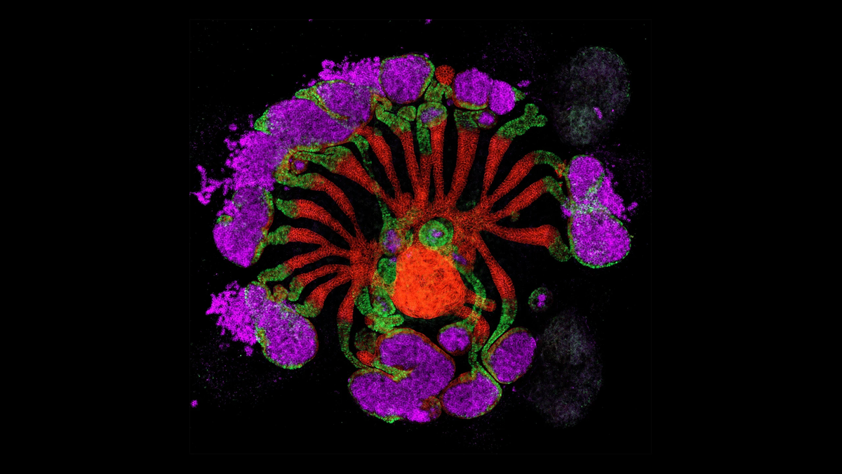    «Искусственная почка». Этот выращенный в лаборатории «ассемблоид» человеческой почки — шаг на пути к созданию искусственных органов. Вокруг центральной дренажной трубки сформировались крошечные фильтрующие элементы, имитирующие строение настоящей почки. При пересадке мышам эти структуры продемонстрировали способность фильтровать кровь и захватывать белки.