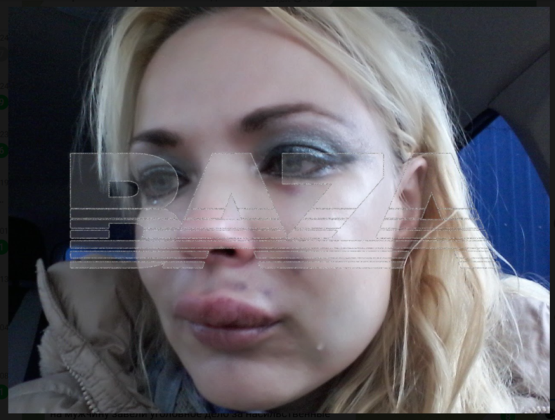    Галина после избиения. Скриншот: Телеграм-канал Baza