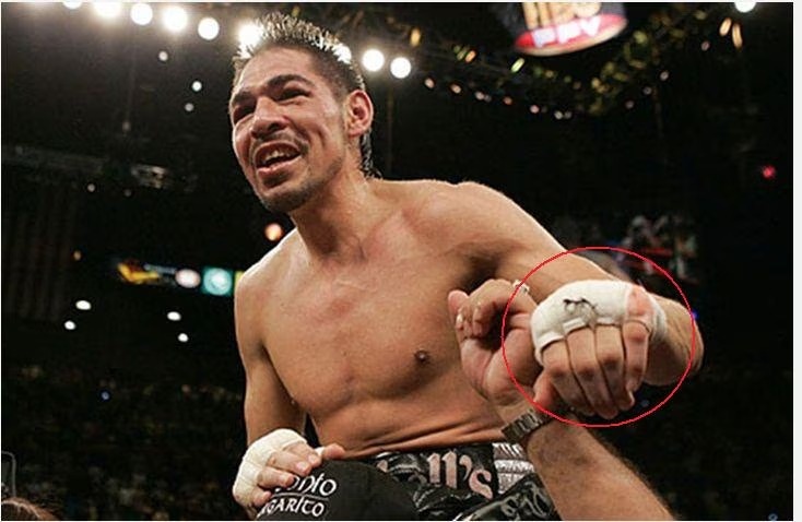 Антонио Маргарито и «гипс» в перчатках (2009)