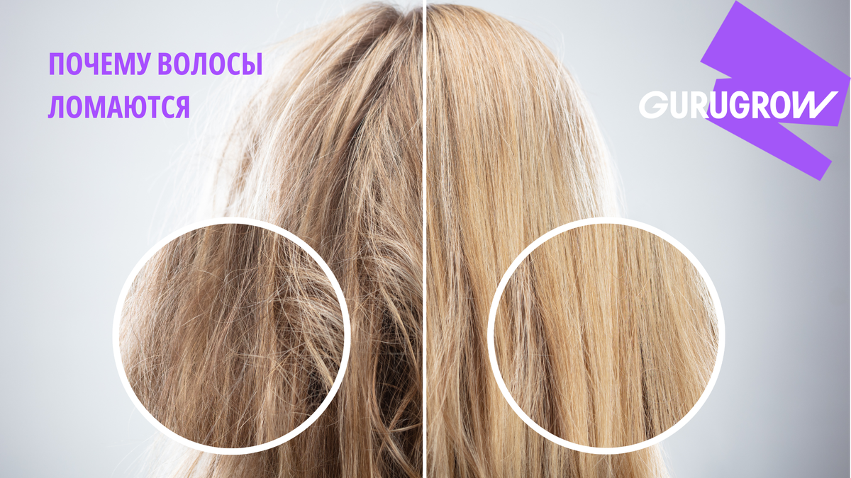 Волосы похожи на солому и сыпятся не от корня — это решаемо