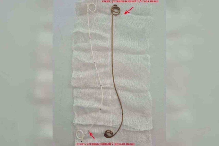    Пресс-служба БСМП №8.