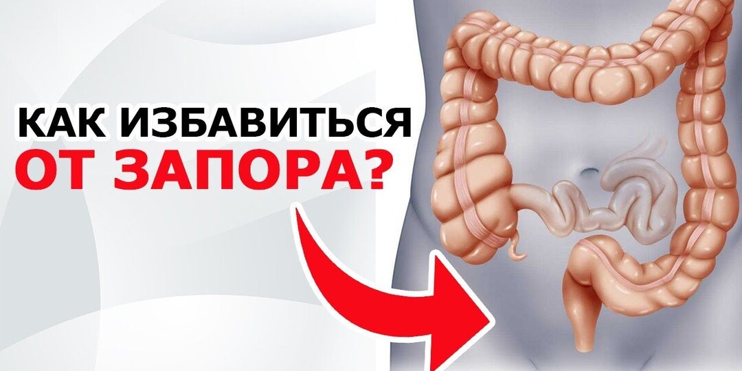 Почему запоры — не безобидная мелочь, а сигнал тревоги для всего организма