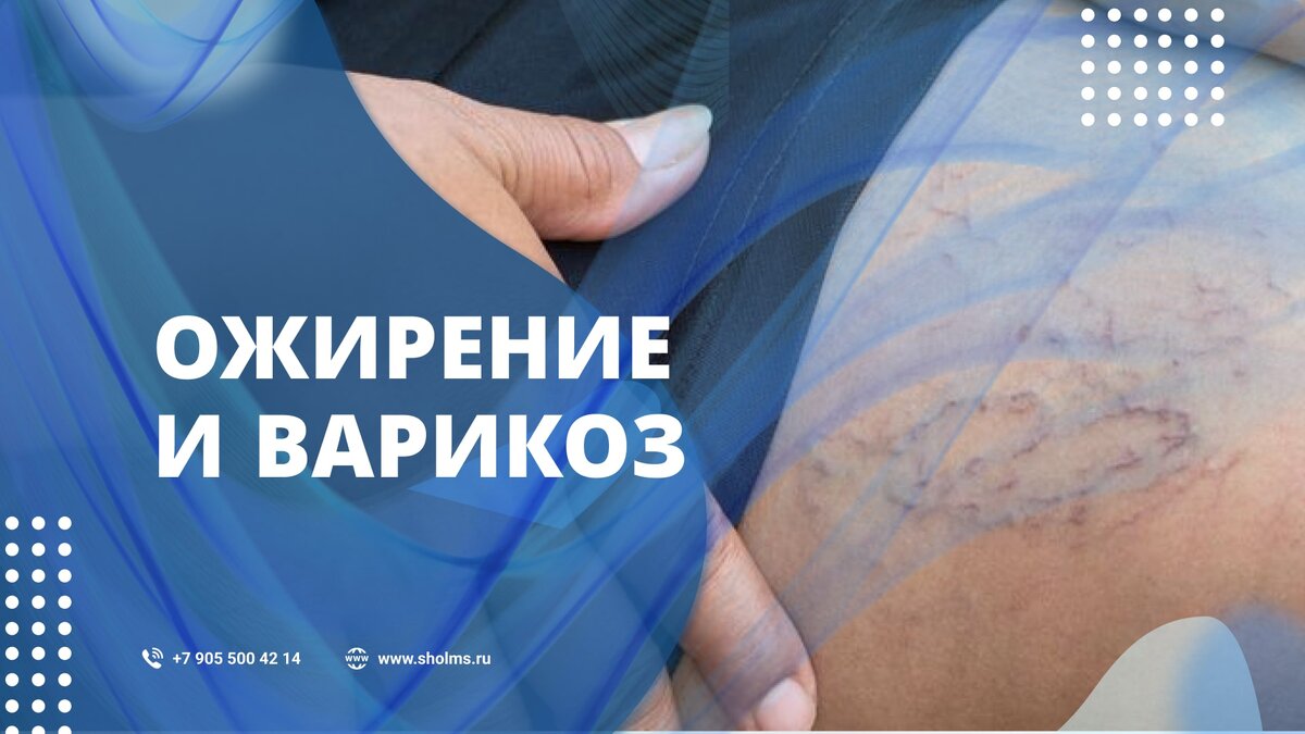 Ожирение и варикоз