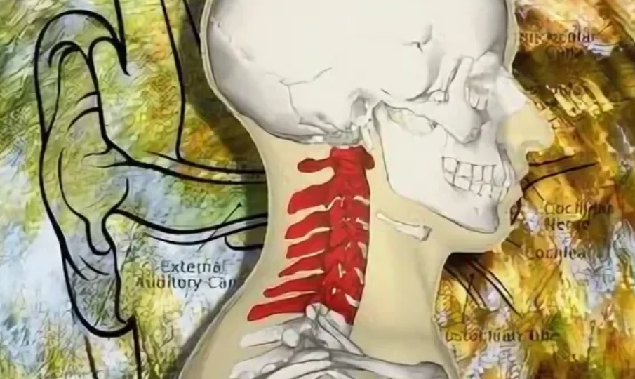 Шейное головокружение. Что за зверь такой? И на сколько он реален.