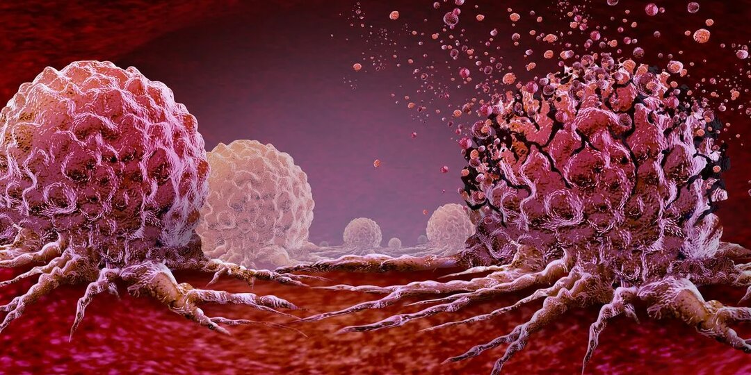 12 правдивых истин о злокачественных новообразованиях, которые спасут тебе жизнь