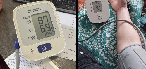 Гипотония и гипертония: как связаны два состояния по версии кардиологов