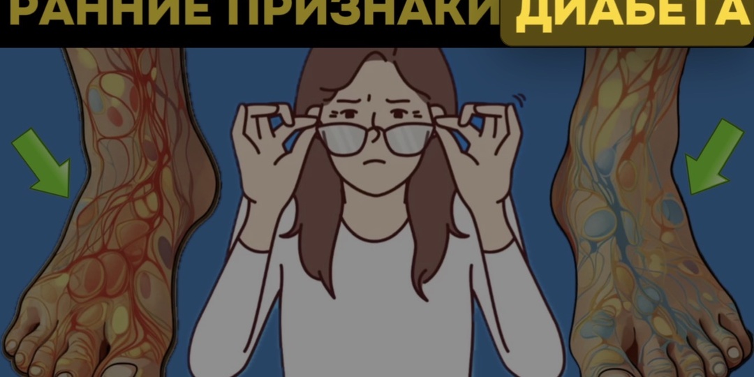 Диабет 2 типа: врач-эндокринолог разбирает мифы и реальные угрозы