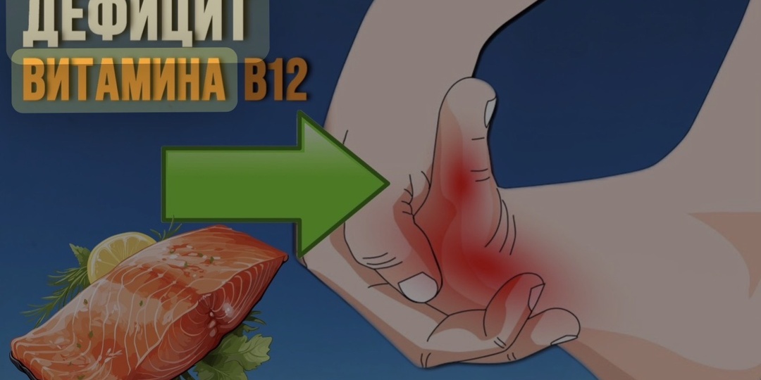 Витамин В12 после 50: 6 сигналов дефицита, которые часто игнорируют даже врачи