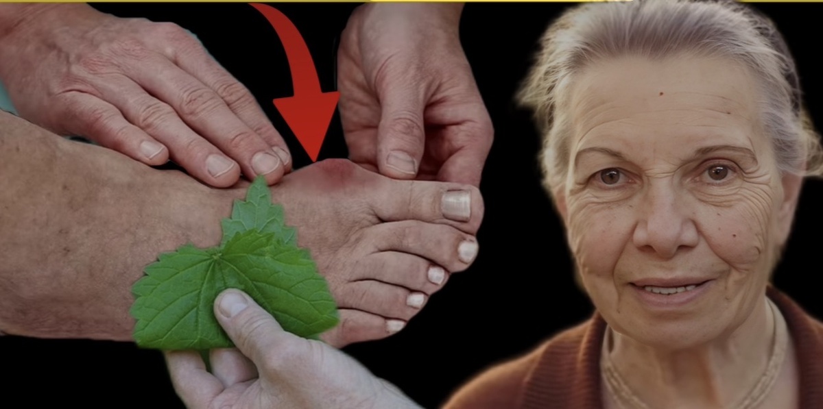  у пациентов с подагрой риск развития диабета значительно повышен