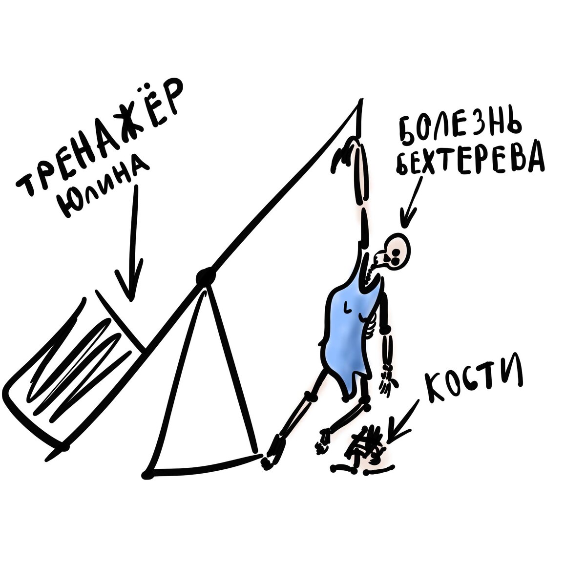 Тренажер Юлина и болезнь Бехтерева