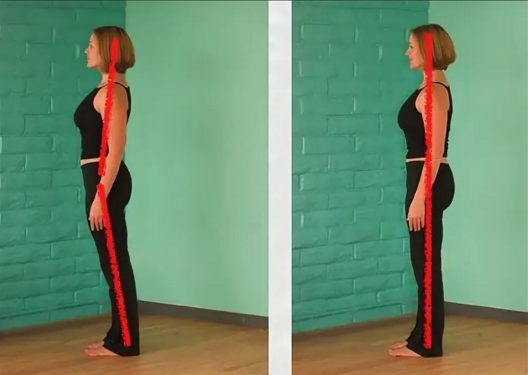 7 простых упражнений для исправления осанки