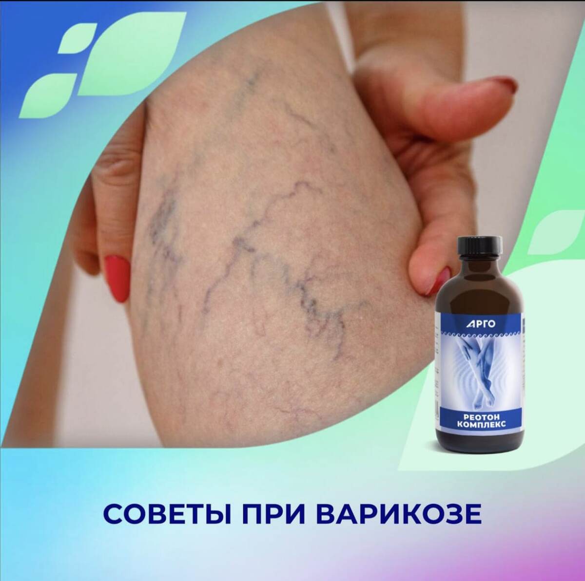 Советы при варикозе

👉Долго стоять и сидеть вредно. Для здоровья вен полезны ходьба, плавание, велотренажёр и йога. Избегайте бега, прыжков и силовых упражнений с большой нагрузкой.

👉Контролируйте вес. Каждый лишний килограмм увеличивает нагрузку на венозную систему.

👉Приподнимайте ноги. 2–3 раза в день на 15–20 минут кладите ноги на подушку или валик так, чтобы они были выше уровня сердца. Это улучшает отток крови и лимфы, снимает отёки и тяжесть.

👉Избегайте перегрева. Горячие ванны, бани и сауны расширяют вены, усиливая застой крови.

👉Пейте достаточно воды. 1,5–2 литра чистой воды в день помогут избежать сгущения крови, что снизит нагрузку на вены и риск тромбоза.

Для целенаправленной поддержки вен принимайте ✅Реотон Комплекс. 

🖍Фитоформула способствует:
✅устранению отёков, болей, судорог, тяжести и жжения в ногах;
✅повышению тонуса вен и уменьшению венозного застоя (венотонизирующее и венопротекторное действие);
✅укреплению стенок сосудов и капилляров;
✅улучшению микроциркуляции и питания тканей;
✅снижению проявлений венозного и лимфатического застоя.

Делая репост моим постам вы делаете здоровей своих друзей в ваших соц.сетях. Нажмите пожалуйста на репост сделав добро. 
Напишите пожалуйста комментарий под этим постом выразив своё мнение на эту тему.