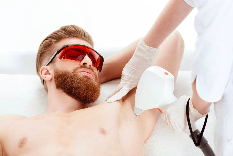 Лазерная эпиляция