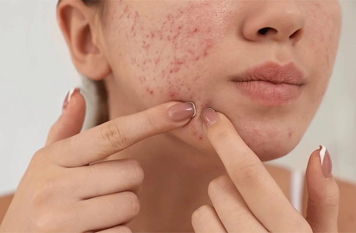 Анализатор кожи лица