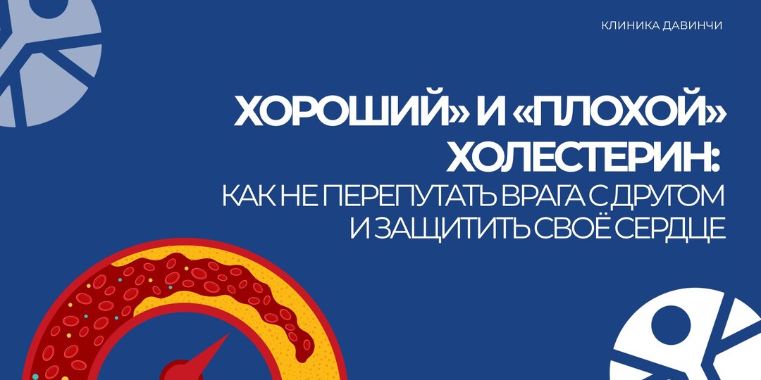 «Хороший» и «плохой» холестерин: как не перепутать врага с другом и защитить своё сердце