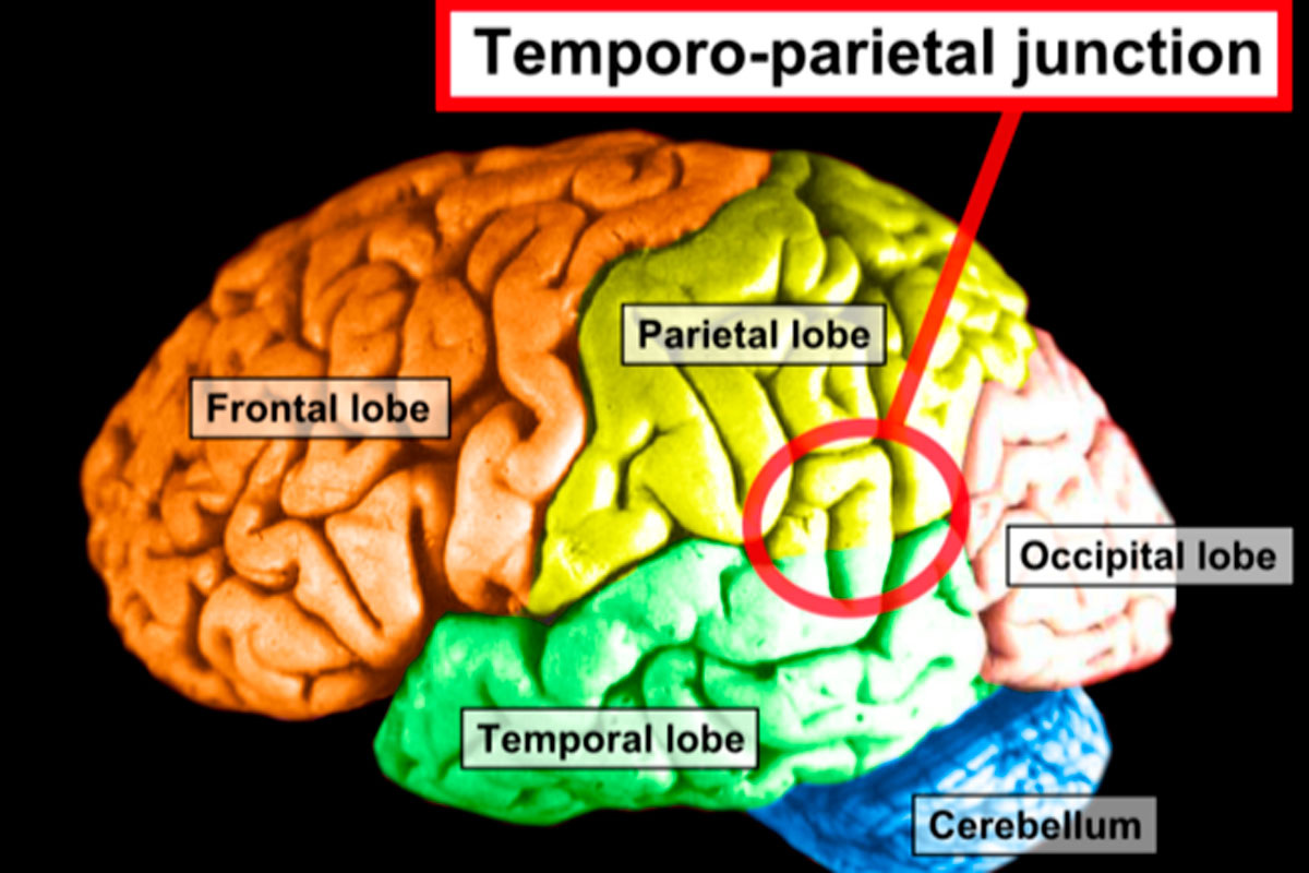 Височно-теменной узел
