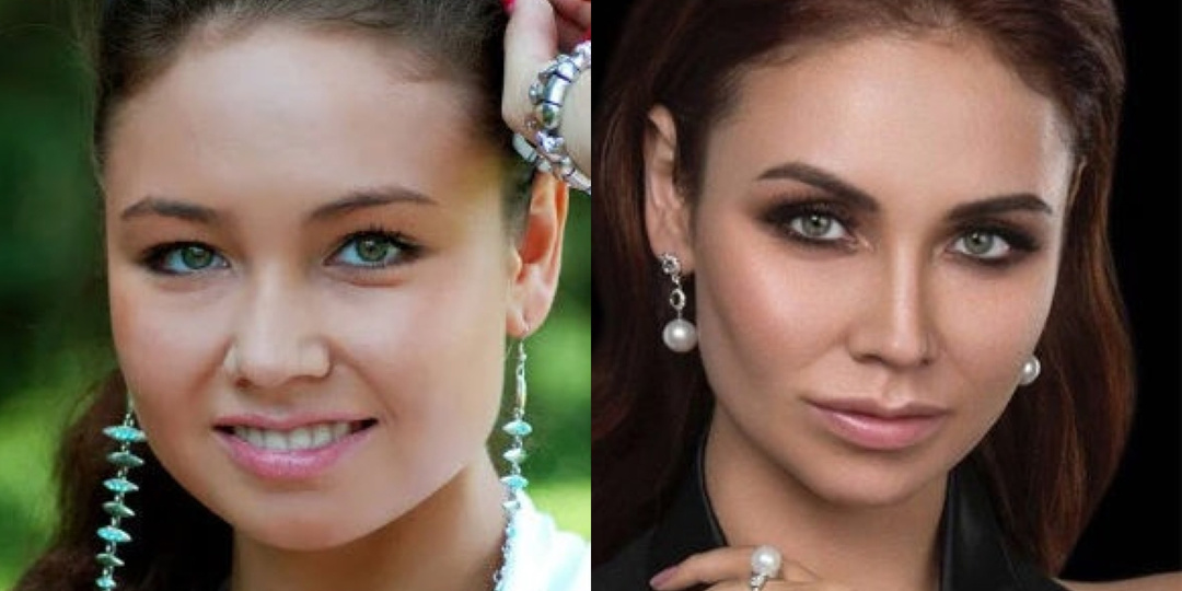 Пластика или возраст: 19 российских знаменитостей, изменившихся до неузнаваемости