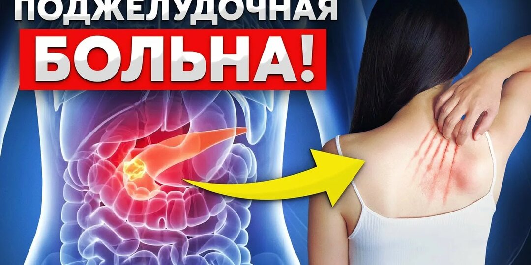 Поджелудочная железа заболела — можно ли вернуть всё как было? Простой разговор о серьёзном