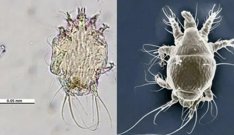 Этот гад , живёт в трахеях наших пчёл