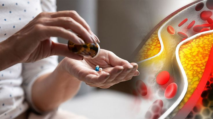 Холестерин повышен? 5 шагов, чтобы спасти сосуды и сердце без вреда для печени