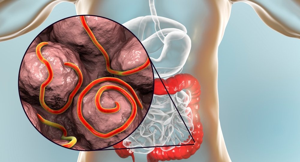 Правда о паразитах в организме человека — как они попадают, что вызывают и как с ними жить