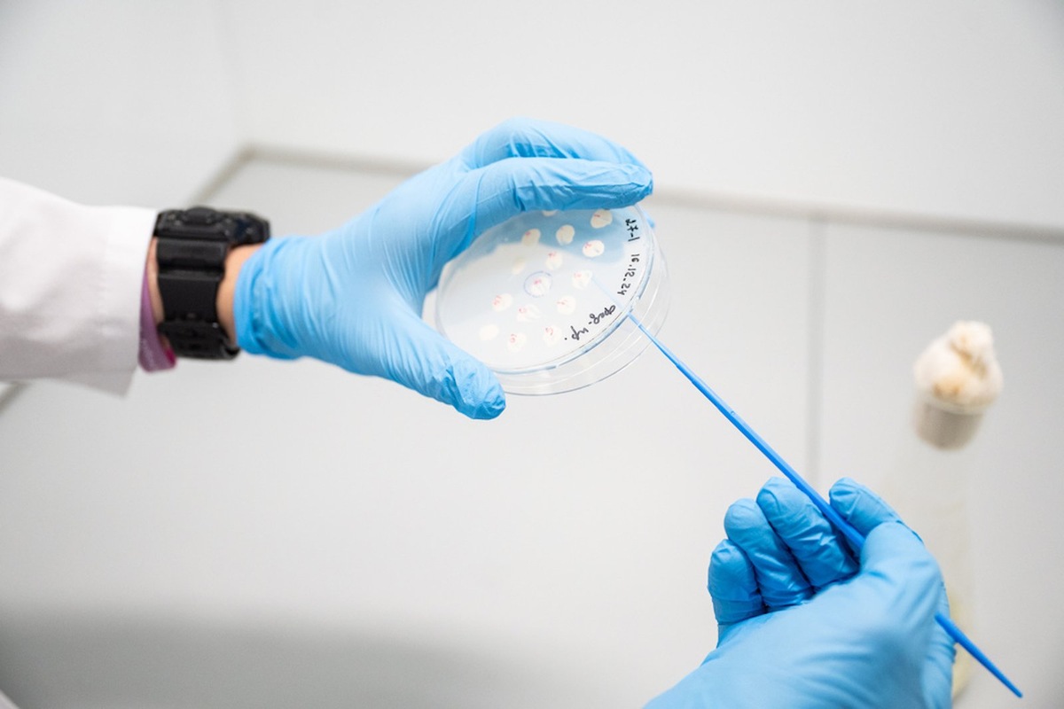    В НИТУ МИСИС разработали инновационный гель для борьбы с кариесом.