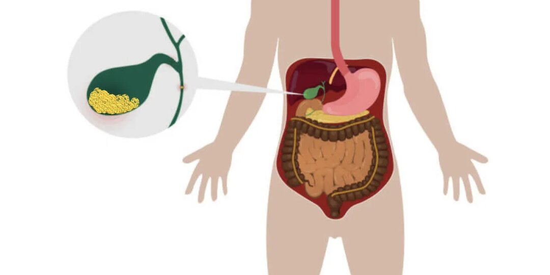 Как застой желчи тихо подтачивает здоровье: сигналы, которые нельзя игнорировать