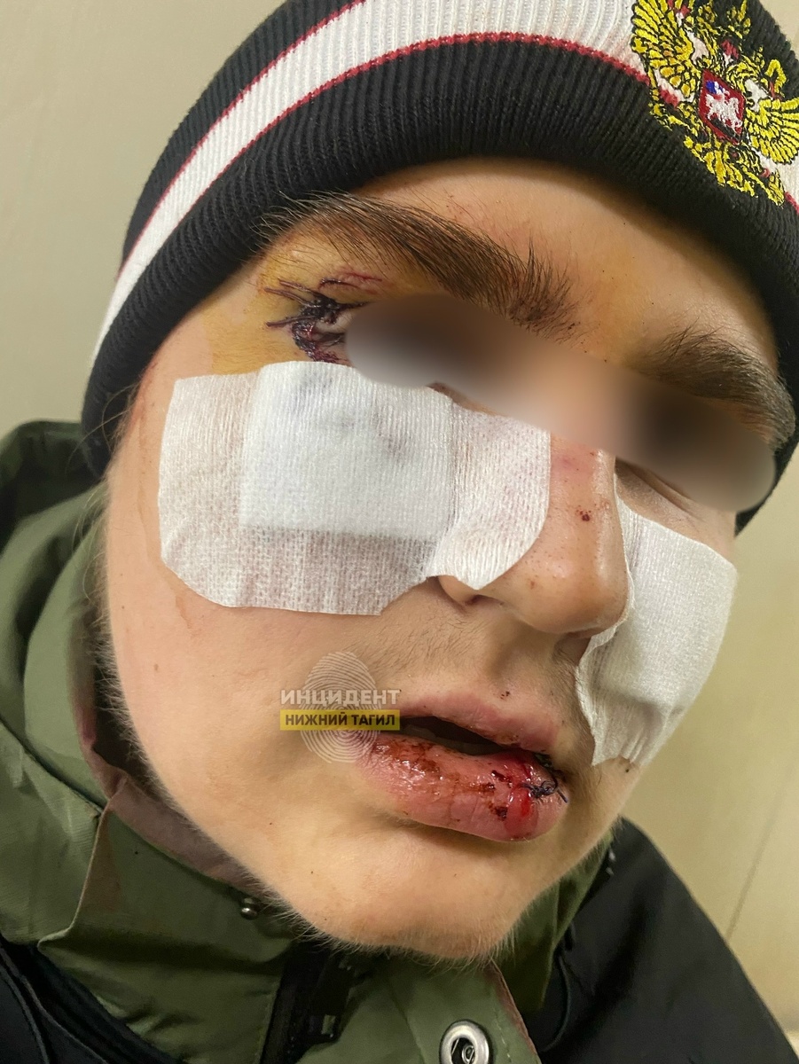 Фото: сообщество «Инцидент Нижний Тагил»