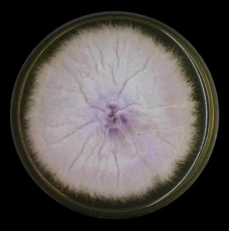 Fusarium oxysporum. Источник: https://micropspbgmu.ru/study_materials.html