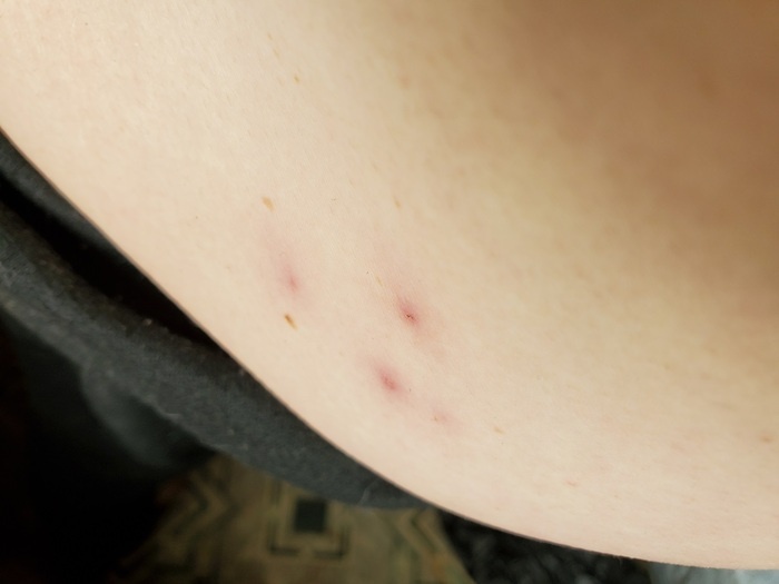 Не думал, что так быстро вылечились.