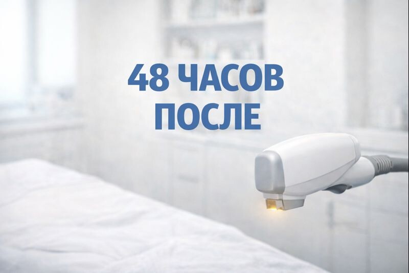 Лазерная эпиляция