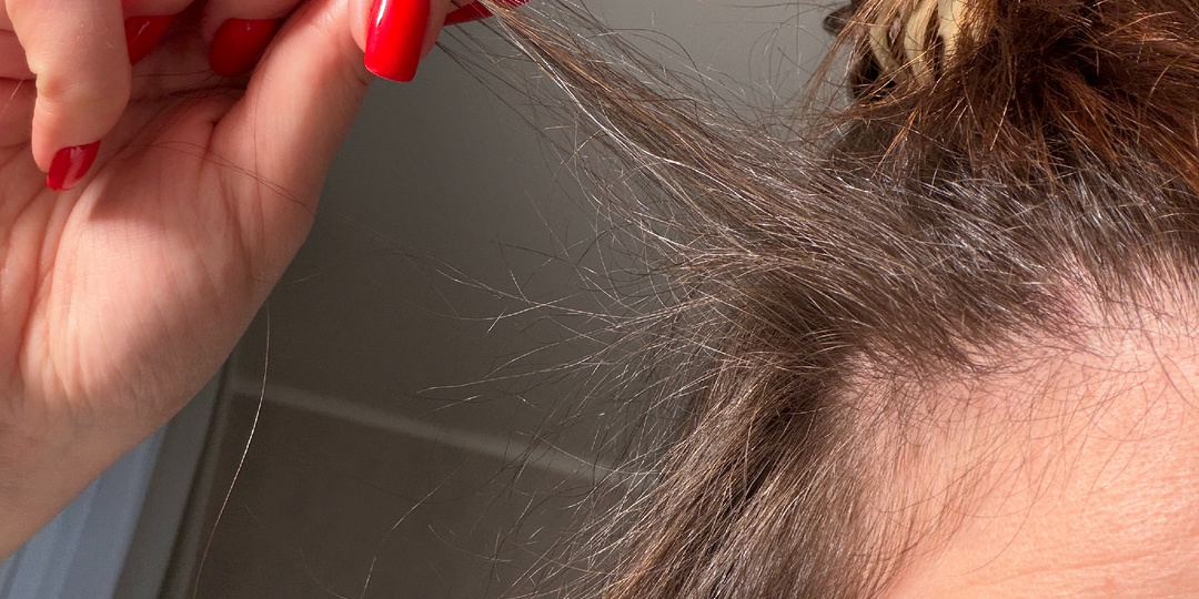 Моя вредная привычка, из-за которой я лишалась волос