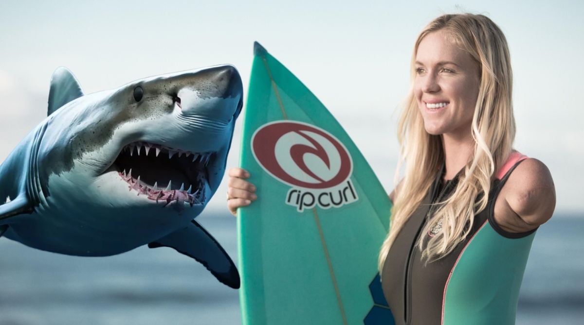 Из жертвы акулы превратиться в легенду серфинга