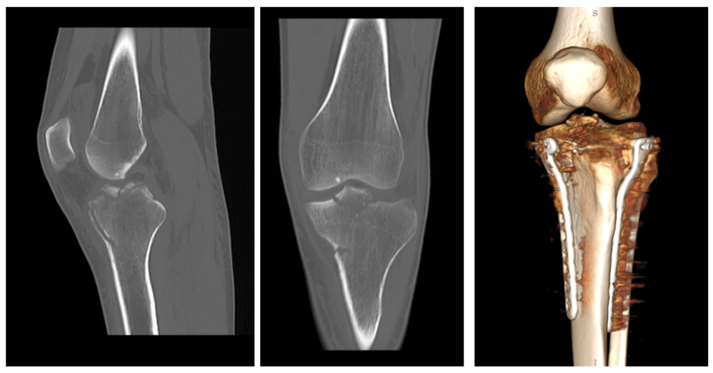 До и после операции