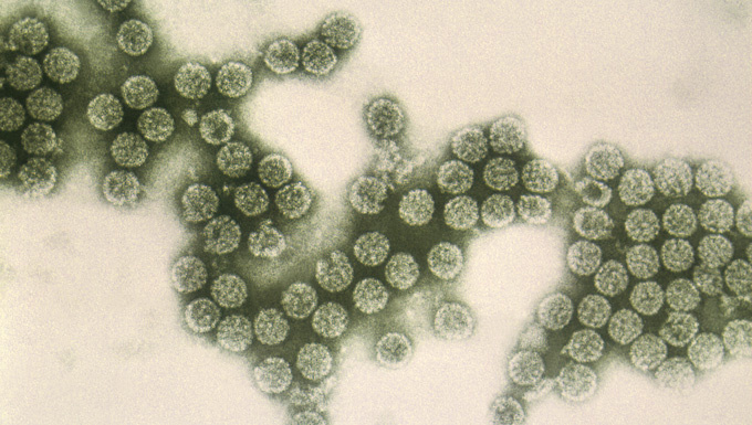    Полиомавирусы, подобные этим на трансмиссионной электронной микрофотографии, были связаны с некоторыми видами рака, а также с поражением почек и головного мозга у людей с ослабленной иммунной системой.   
Фото: Erskine Palmer/CDC