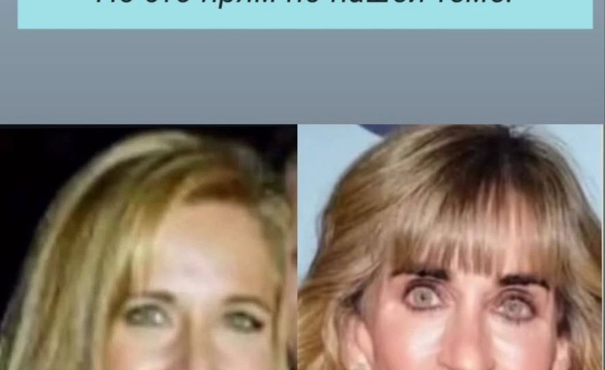 Сьюзан Делл и ее максилла😳