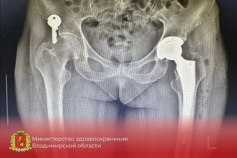 Фото: Минздрав Владимирской области