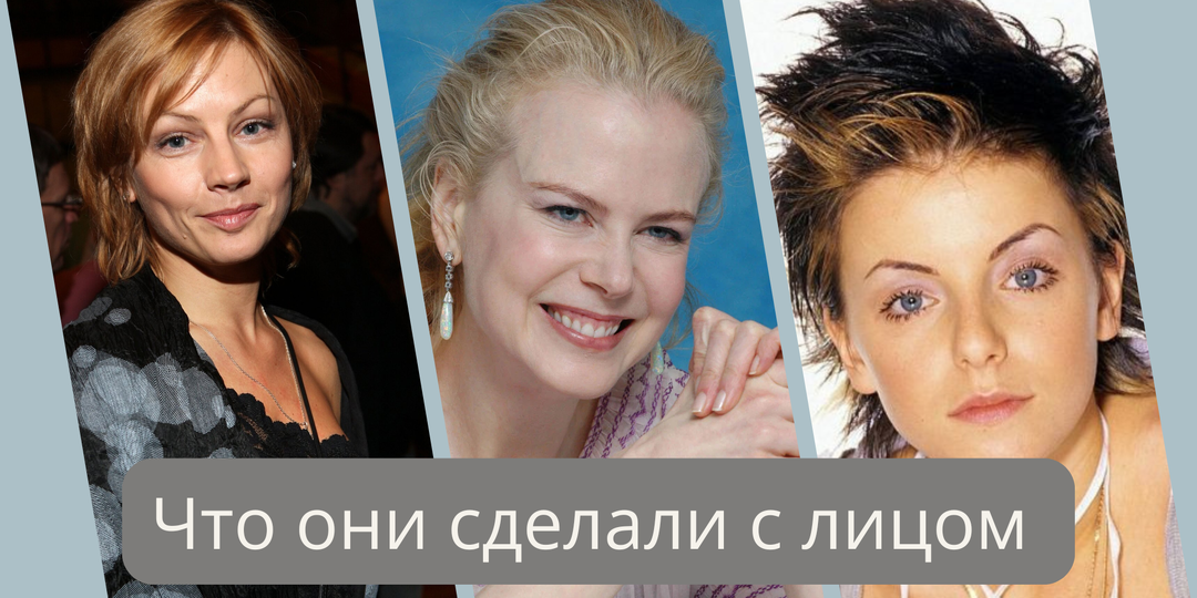 Они изменились до неузнаваемости: звёзды, которые переборщили с внешностью