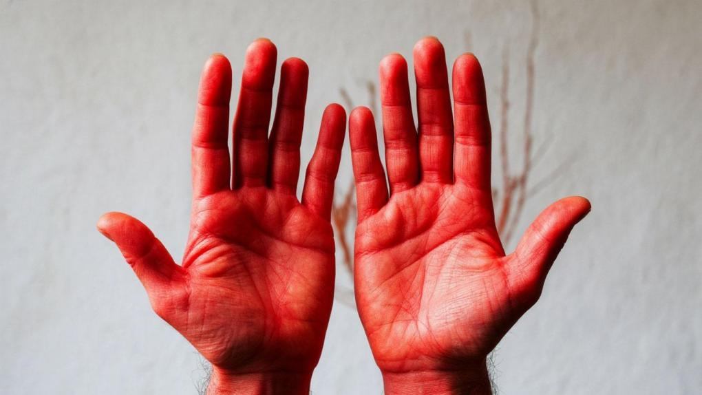 Печёночные ладони. nsk.om1.ru