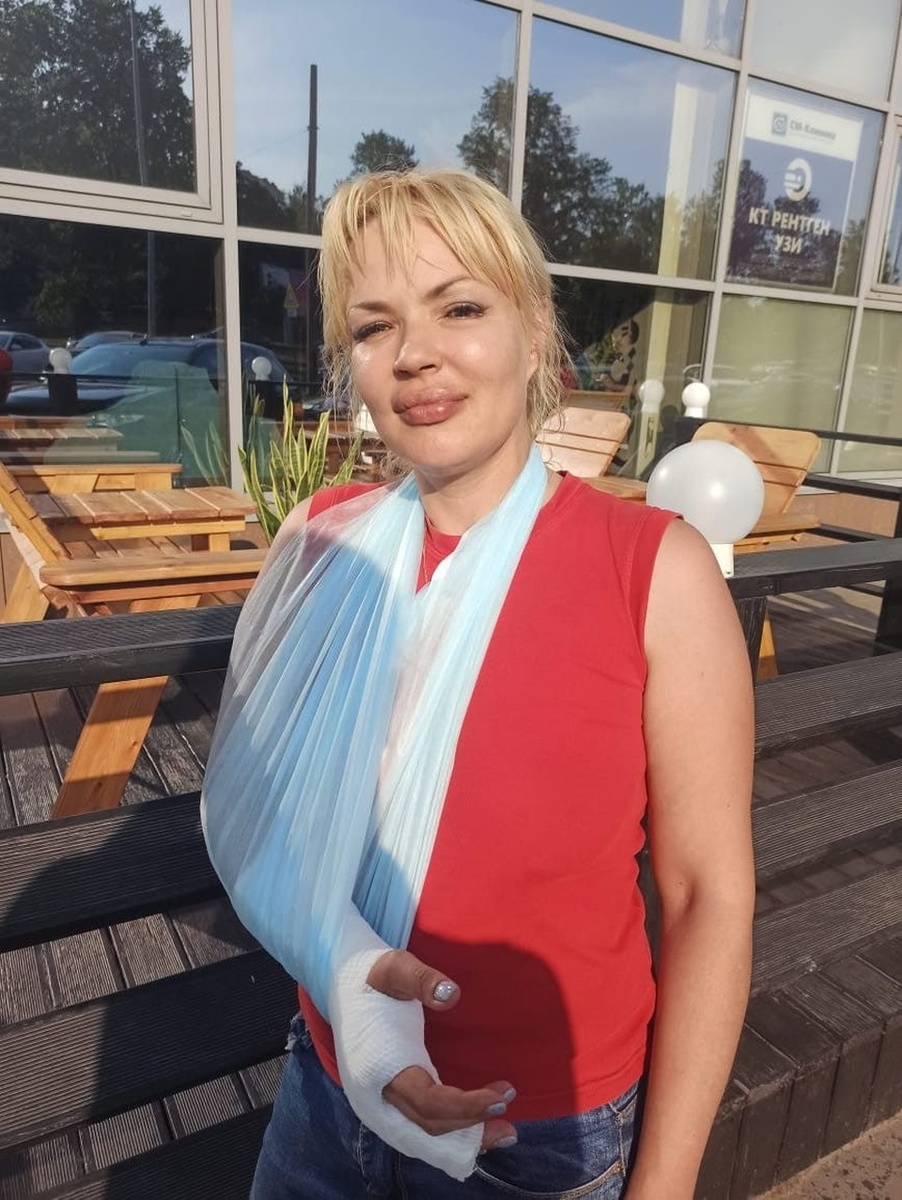    Муж-иранец ломал Галине руку и ребра. Фото: предоставлено "КП-Петербург"