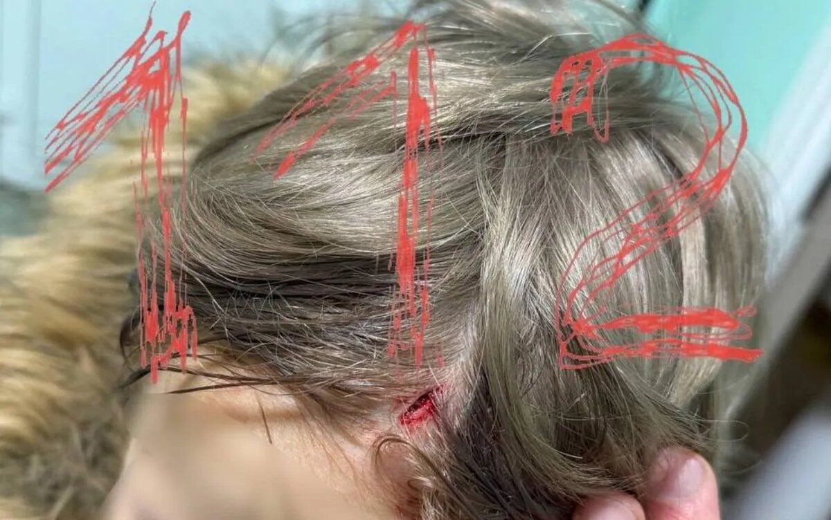    СК начал проверку после травмы ребенка в ресторане Ижевска